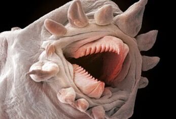 Cacing apa yang boleh hidup di dalam tubuh manusia