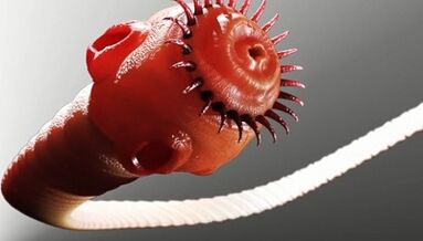 Jenis parasit dalam tubuh manusia